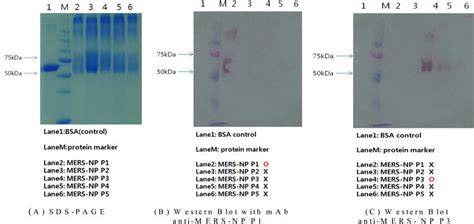 SDS PAGE And Western Blot Analysis Of 5 Synthetic Peptides For The