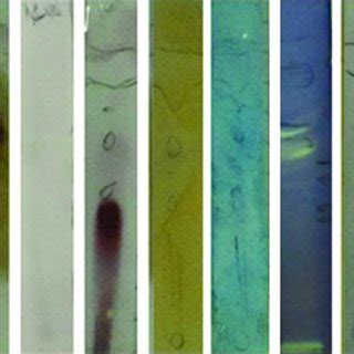 Tlc Bioautography Of Ag A Methanol Extract Supernatant From Right To