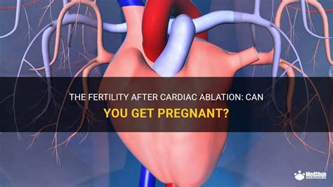 The Fertility After Cardiac Ablation Can You Get Pregnant Medshun