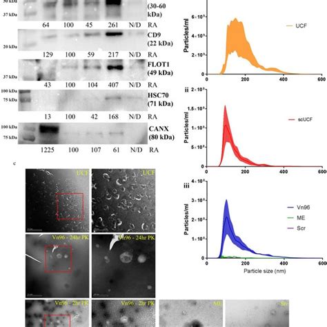 Characterization Of Plasma Evs Isolated By Ucf Scucf And Vn Methods