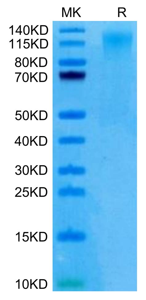Human Cd96tactile C110s Protein Cd9 Hm19s Kactus