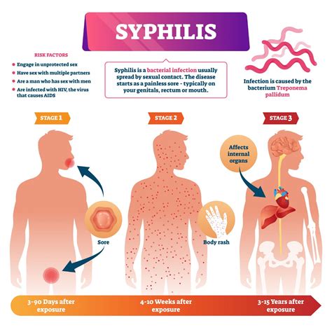 Secondary Syphilis- The Great Imitator and Pretentious Rash - Dr Ben Medical - Men's Health ...