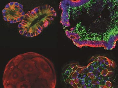 Organoids Precisionary Instruments