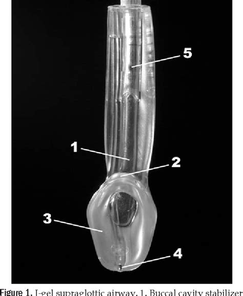 Figure 1 From Fiberoptic Intubation Through An I Gel Supraglottic