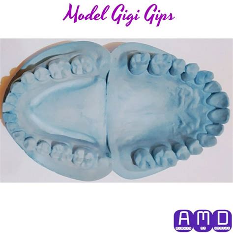 Jual Model Gigi Gips Biru Rahang Atas Dan Rahang Bawah Shopee Indonesia