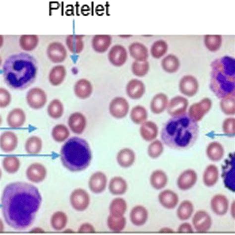 Peripheral Blood Smear Image 19 Download Scientific Diagram