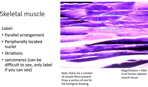 Solved Skeletal Muscle Label Parallel Arrangement Peripherally Located