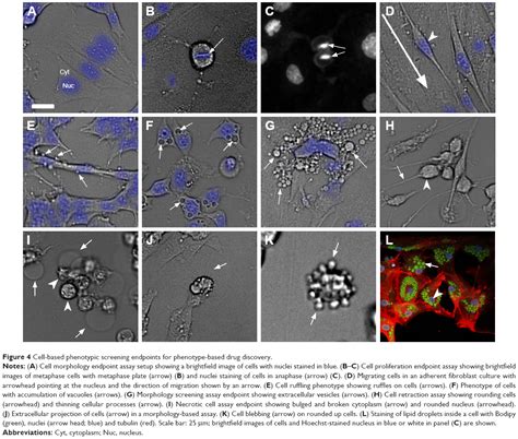 Cell And Small Animal Models For Phenotypic Drug Discovery Dddt