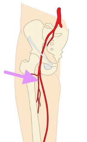 Lower Extremity Venous And Arterial Imaging Flashcards Quizlet