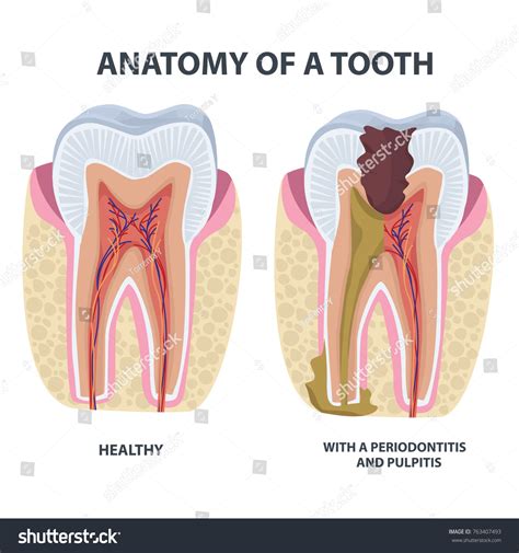 Tooth Anatomy Vector Dental Infographics Enamel Stock Vector Royalty