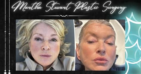 Martha Stewart Plastic Surgery News: Just Fake Rumors or Reality ...