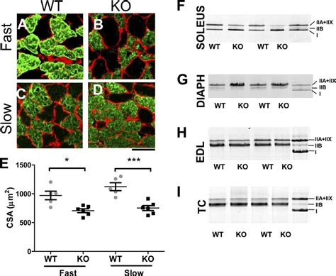 Soleus Muscle Fibers From Ig Ko Mice Have A Decrease In Fiber Csa And