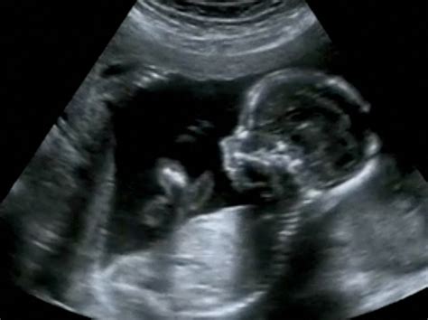 Your Pregnancy Scans And What To Expect The Real Birth Company Ltd