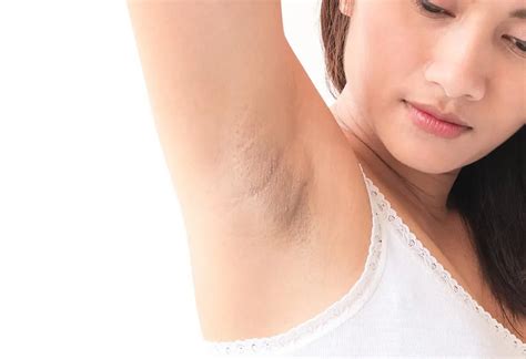 10 Simple And Effective Home Remedies For Dark Underarms