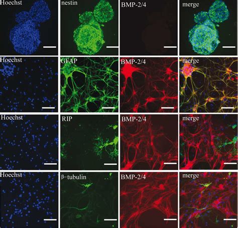 The Characteristics Of Nscs And Expression Of Bmp In Nscs And Their