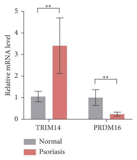 Expression Of Trim14 And Prdm16 In Peripheral Blood Mononuclear Cells