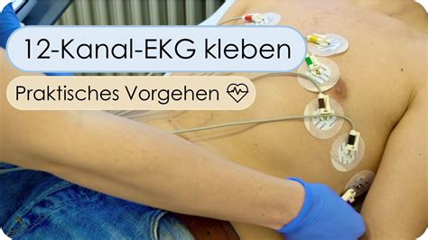 Anlage Eines Kanal Ekg Skills Ekg Kleben Ekg Elektroden