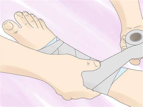 How To Wrap A Sprained Ankle 14 Steps With Pictures Artofit