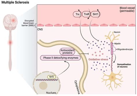 Antioxidants Free Full Text The Role Of The Thioredoxin System In