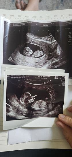 Week Ultrasound Gender Babycenter