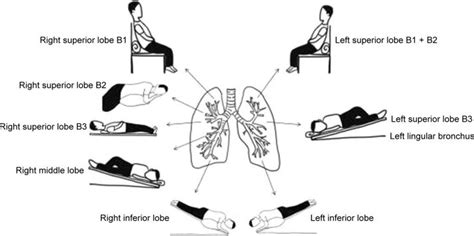 Postural Drainage Positioning