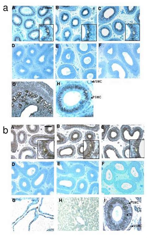 Immunohistochemical Localization Of Er And Er In The Bonnet Monkey