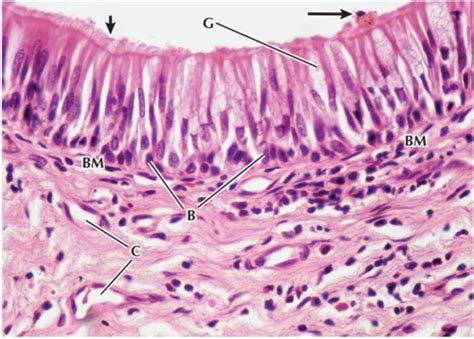 Respiratory System Histology Flashcards Quizlet