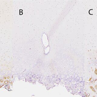 Photomicrographs Depicting Protein Expression For Lubricin Following