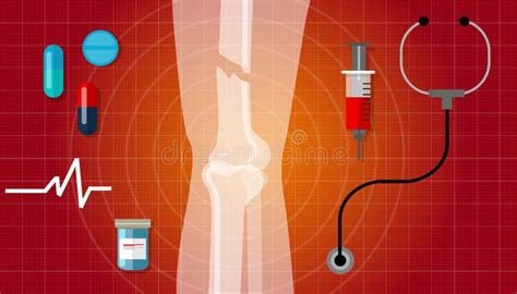 Ícone Humano Da Ilustração Do Tratamento Médico De Raio Da Anatomia X