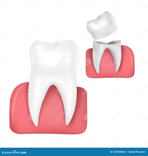 Tooth Anatomy Medical Banner 3D Vector Infographics Dental Poster