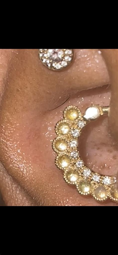 Navel piercing anatomy : r/Legitpiercing