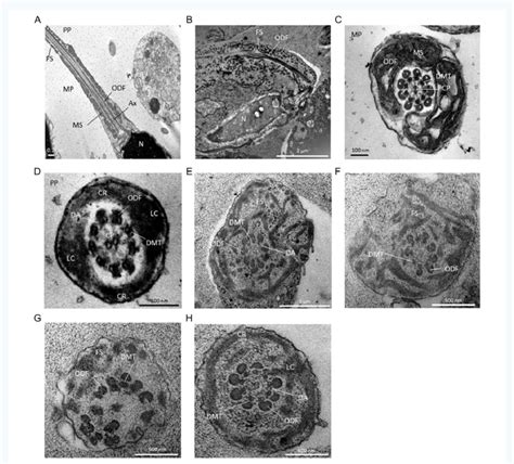 Transmission Electron Microscopy Analyses Of Sperm Cells From A Control