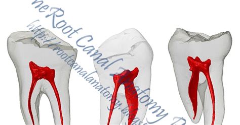 The Root Canal Anatomy Project: Mandibular Second Molar