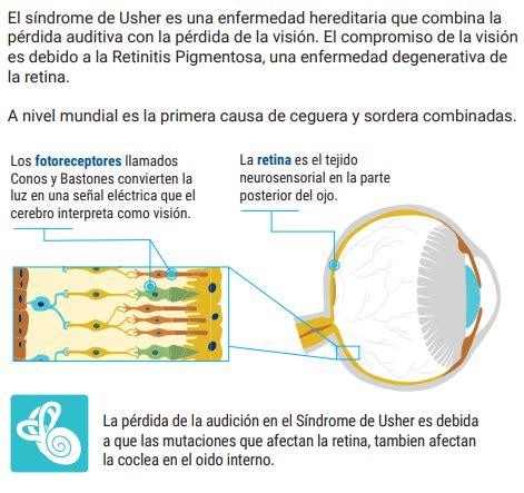 Sindrome De Usher Oculogenetica