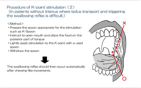 53 Techniques To Facilitate Swallowing In Direct Training