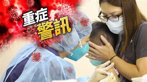 中重症137！9歲男童爆mis C休克住加護 兒童重症累計264例