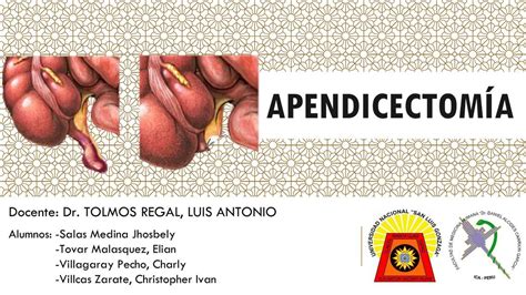APENDICECTOMÍA | JHOSBELY SALAS MEDINA | uDocz