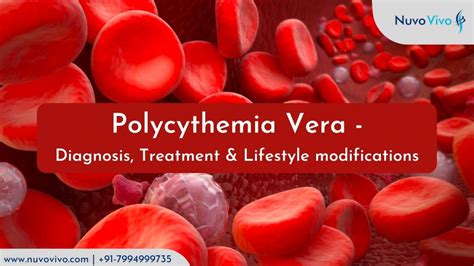 Polycythemia Vera Symptoms Treatment Lifestyle Changes Nuvovivo