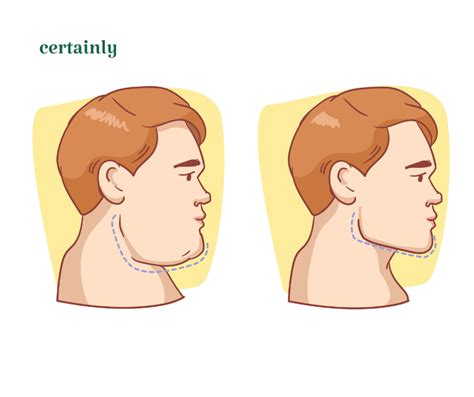 Benefits And Risks Of Masseter Botox For Tmj Disorder Certainly Health