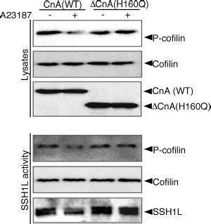 A Induced Cofilin Dephosphorylation And Ssh L Activation Are