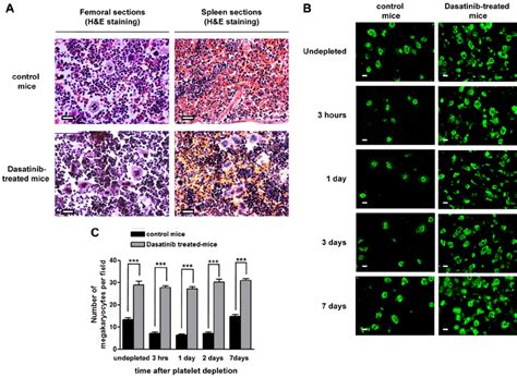 Dasatinib Induces An Increased Number Of Mature MKs In BM And Spleen