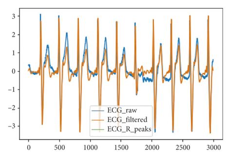 Ecg Filtered And R Peak Detected Of The Signal In Hz Sample Rate