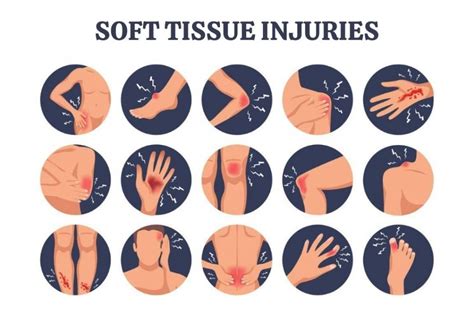 11 Best Tips For Soft Tissue Injuries Management