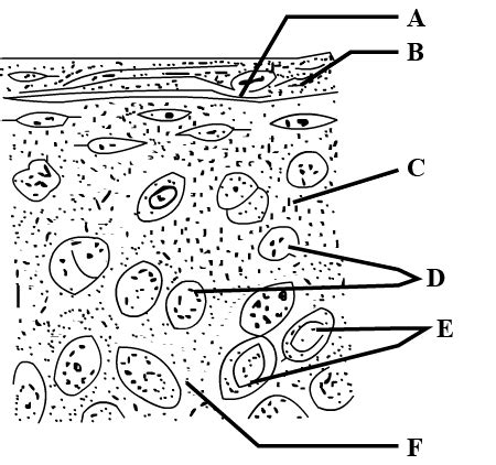 Hyaline Cartilage Labeled Diagram