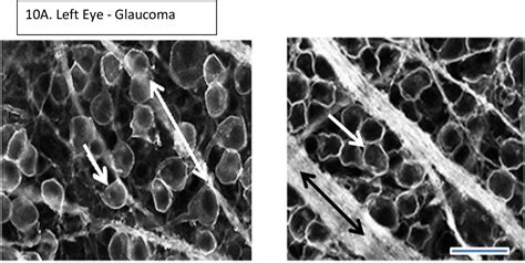 Figure 10 From Retinal Ganglion Cell Neuroprotection Induced By