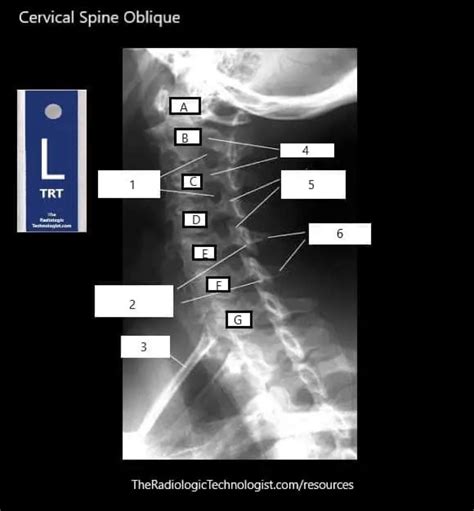 Cervical Spine Oblique Diagram Quizlet