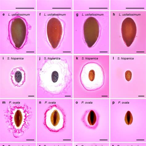 Visual Inspection Of The Ruthenium Red Stained Seed Mucilage Of Five