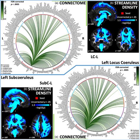 Structural connectivity results of locus coeruleus—LC (top) and... | Download Scientific Diagram