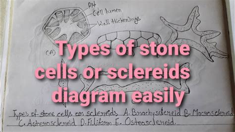 A Brachysclereid B Macrosclereid C Asterosclereid D Filiform E