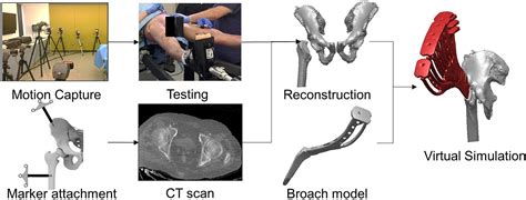 Contributions Of Capsular Releases To Femoral Exposure In Total Hip Arthroplasty Via The Direct